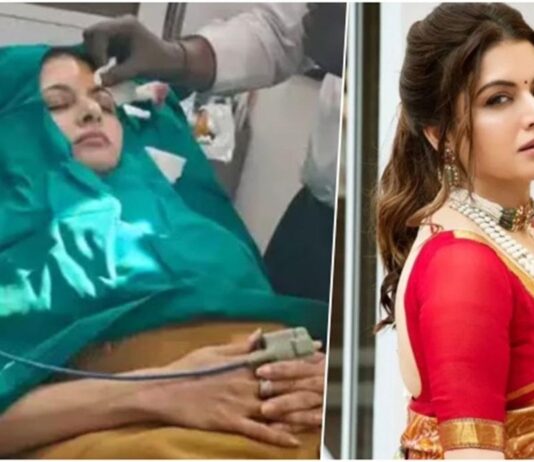 இந்தி நடிகை பாக்யஸ்ரீ விபத்தில் படுகாயம்: நெற்றியில் 13 தையல்