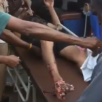 குளச்சல்: ஐஸ் இயந்திரத்தில் கால் சிக்கி தொழிலாளி படுகாயம்