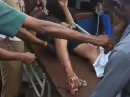 குளச்சல்: ஐஸ் இயந்திரத்தில் கால் சிக்கி தொழிலாளி படுகாயம்