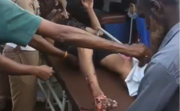 குளச்சல்: ஐஸ் இயந்திரத்தில் கால் சிக்கி தொழிலாளி படுகாயம்